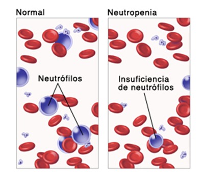 infiltracion de
leucocitos neutrofiloos