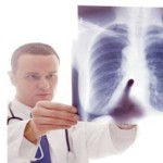 fibrosis quistica fibrosis quistica