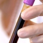 eosinofilos eosinofilos