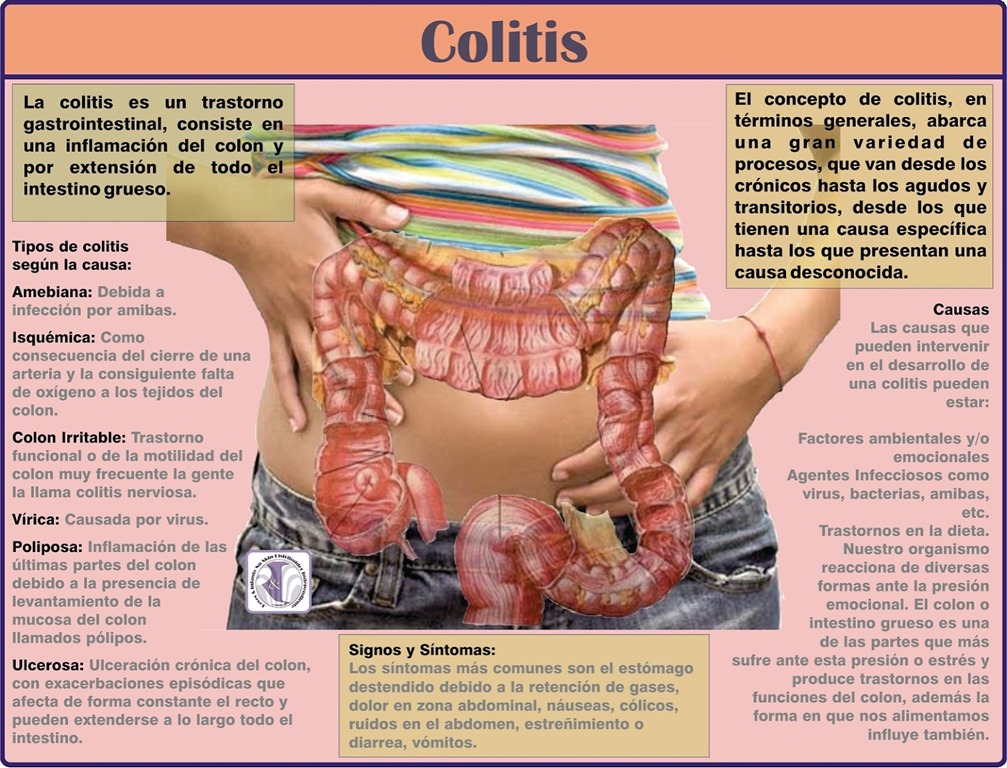 Dieta colon irritable pdf