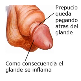 Si al muchacho el pequeño miembro